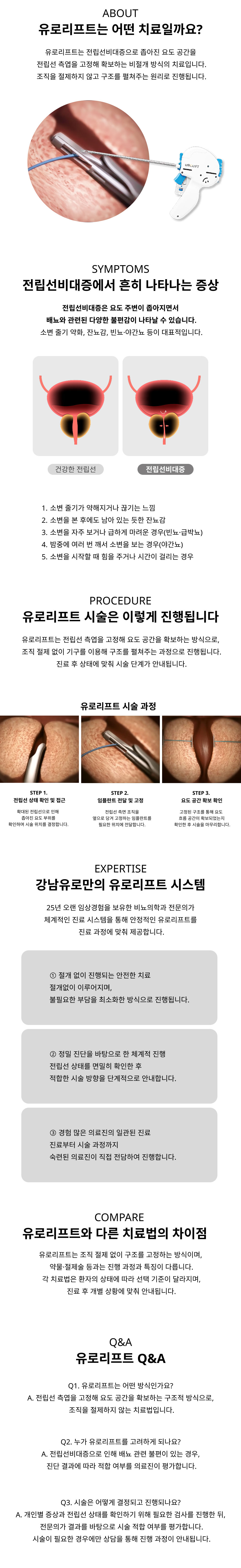유로리프트는 전립선비대증으로 좁아진 요도 공간을 전립선 측엽을 고정해 확보하는 비절개 방식의 치료입니다. 조직을 절제하지 않고 구조를 펼쳐주는 원리로 진행됩니다